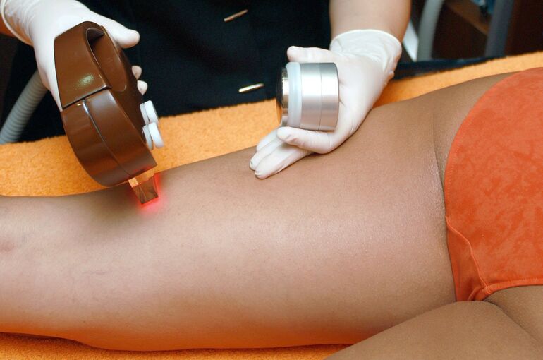 hair-removal-4188610_1920